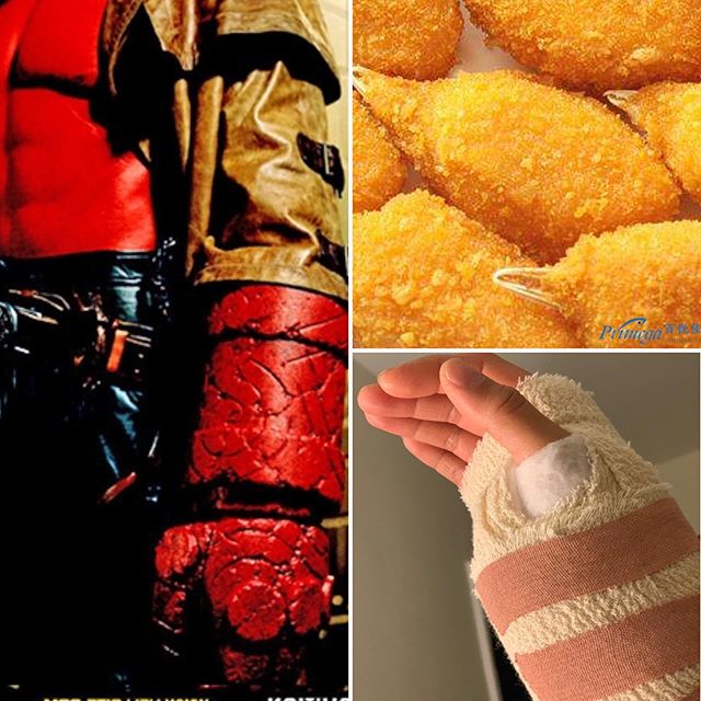 Who wore it better? @hellboymovie 👺/ @wingyipstore #breadedcrabclaws 🦀/ or my #carpaltunnel 😹? 🤕
#makeafist #houseofpain #chronic #pain #funnyordie #busted #limpwrist #postop #postsurgery #astichintime #oww #enforcedrest #becausehormones #because #hypermobilitysyndrome #womenmoreproneintheir30s #gottolaugh #ilovethenhs #filipinonurses #filipinonursesoncallthemidwife #carpaltunnelsurgery (Really fancy some crab rn)