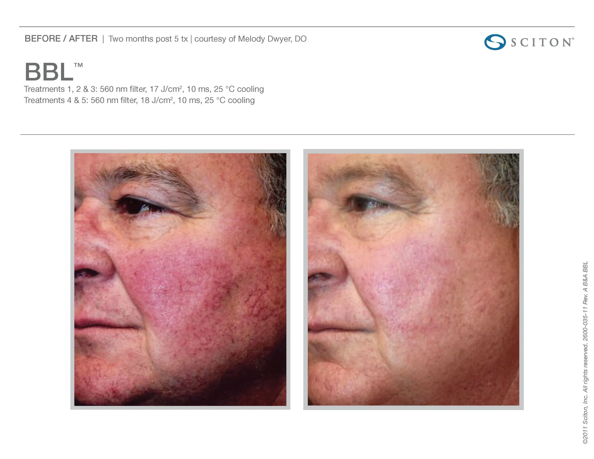 BBL B&A Nov'17_Page_18.jpg