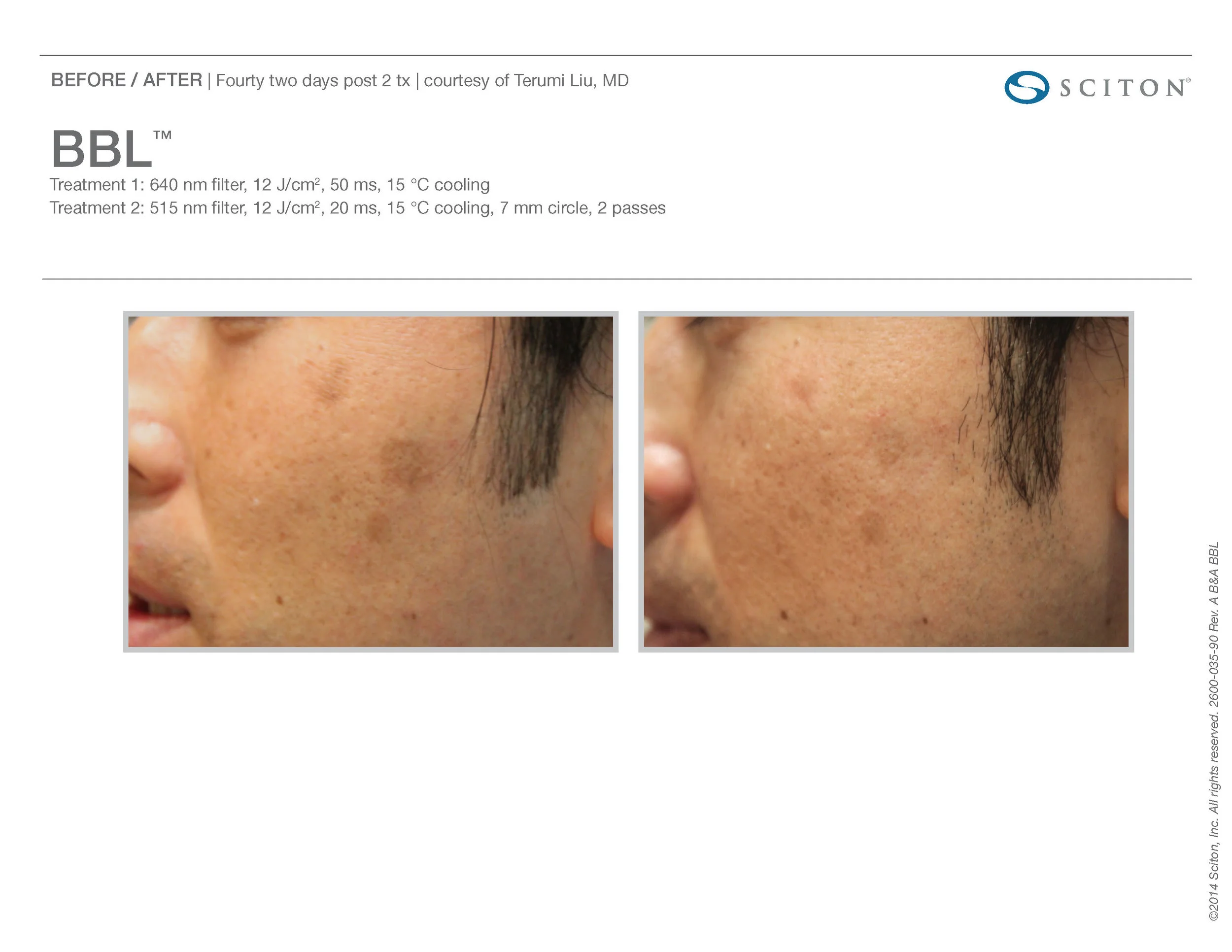 BBL B&A Nov'17_Page_33.jpg