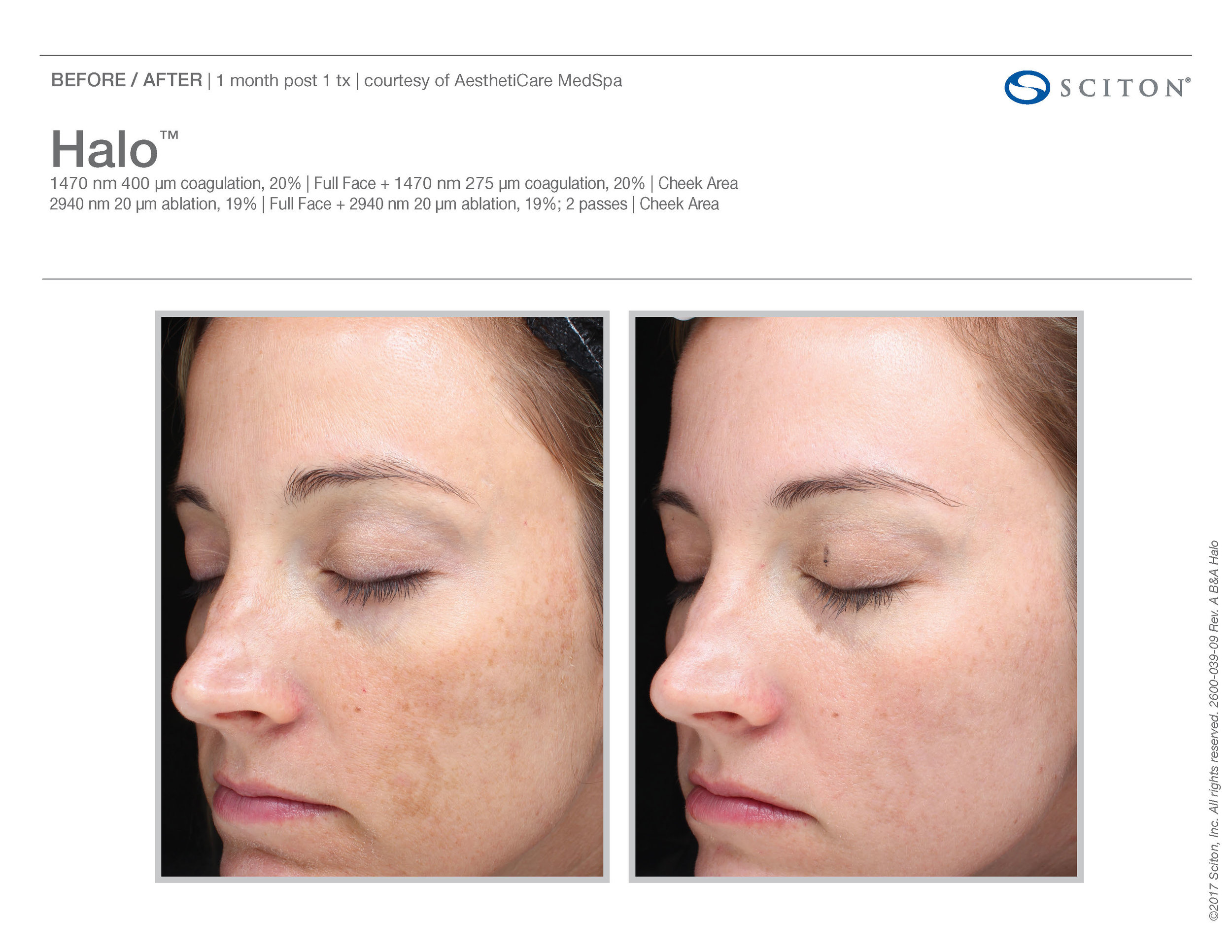 Halo B&A Nov'17_Page_25.jpg