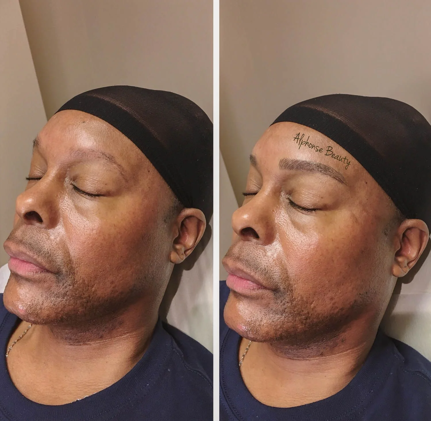 Alphonse Beauty Microblading Michigan Gallery