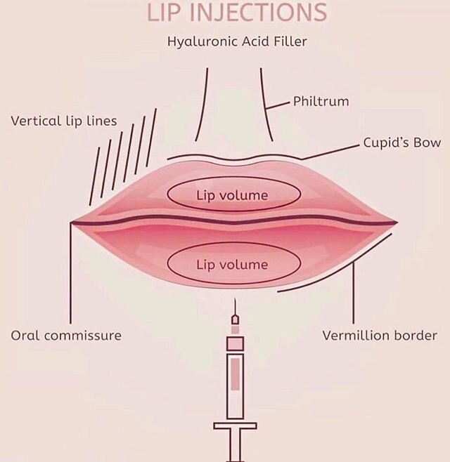 Lips come in all different shapes and sizes. For me it is one of the most sensual and attractive features of the face when they are in balance and harmony with other facial features. 
Some people have naturally volumous lips and some clients look mor