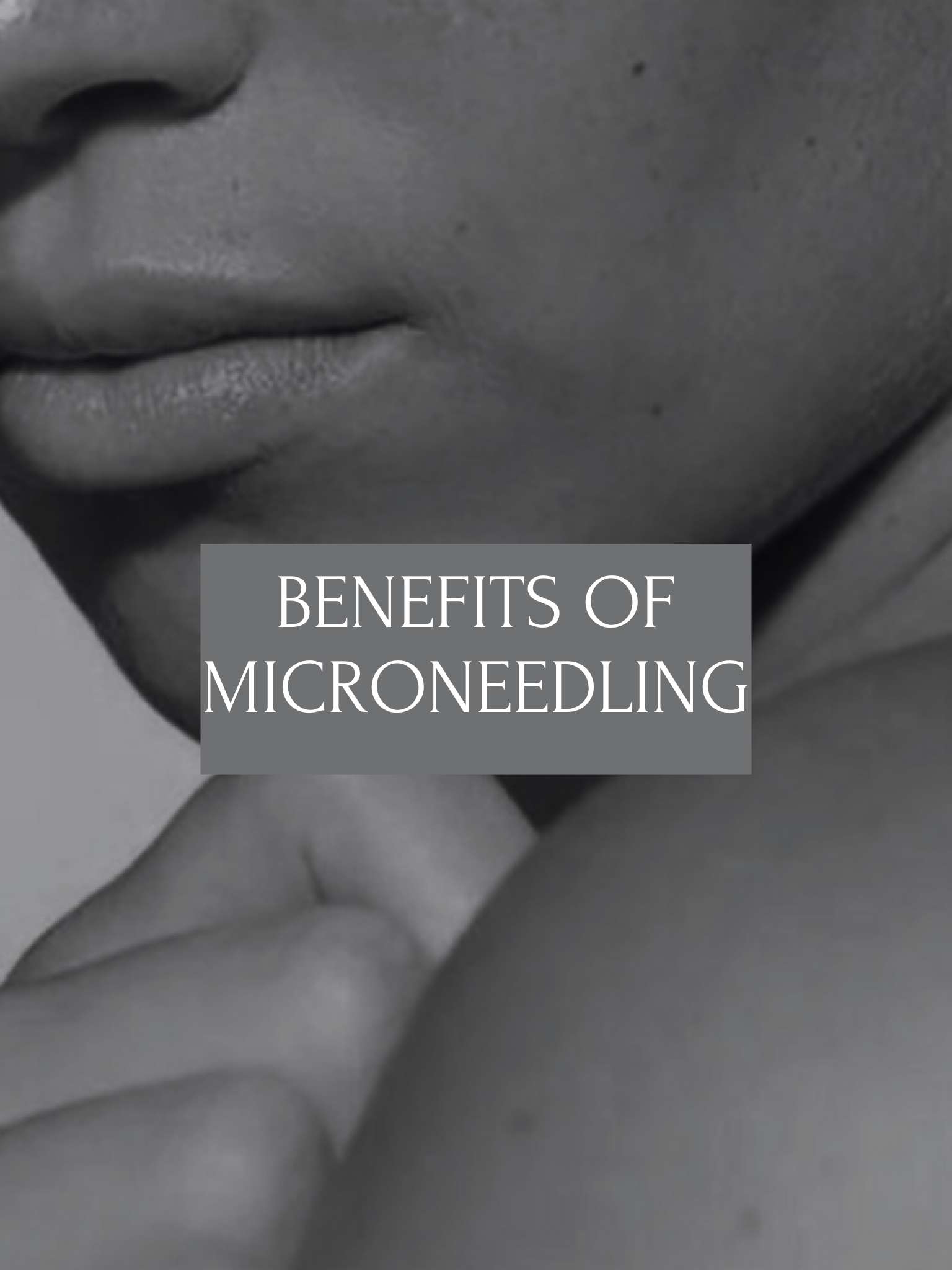 Microneedling: Evidence-Based Benefits For Skin Health At All Ages