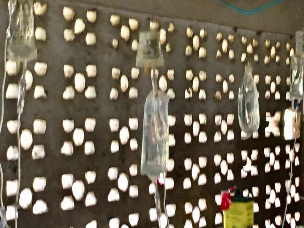 IVs