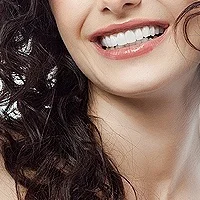 SMILE MAKEOVER