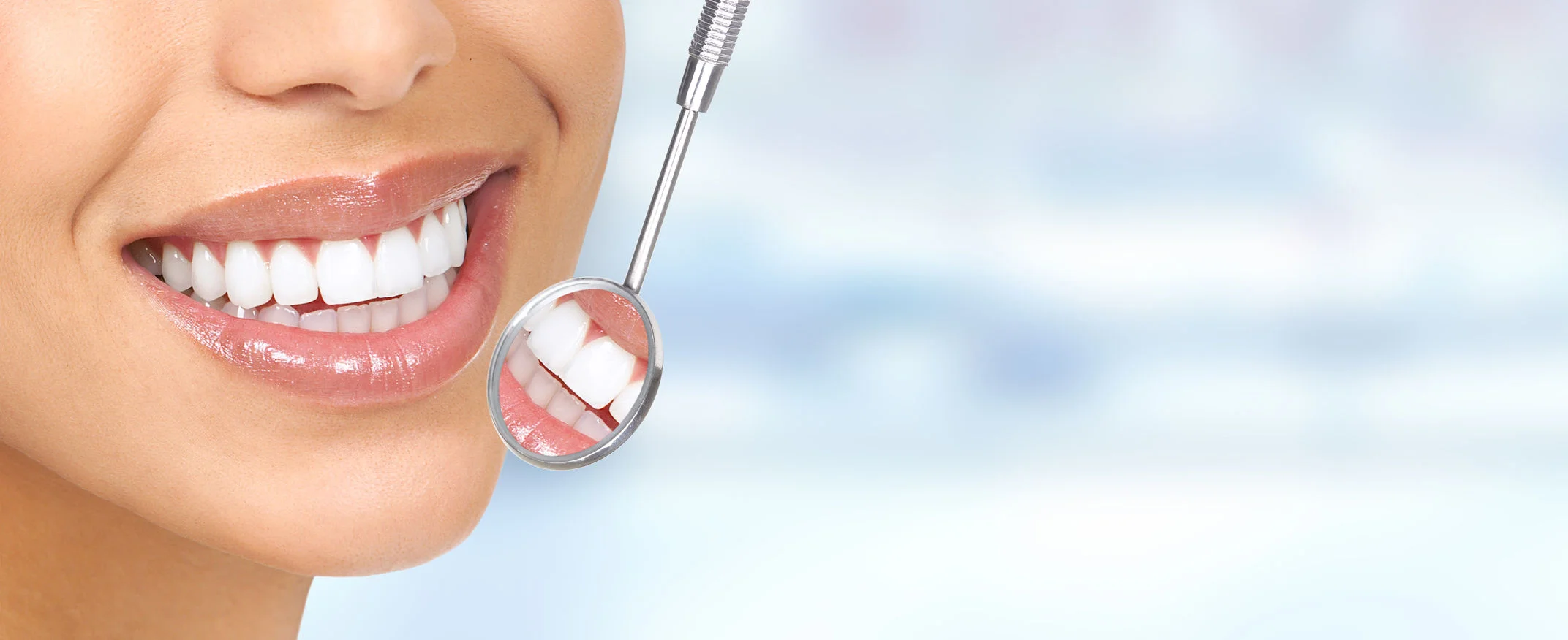 Dental Bonding