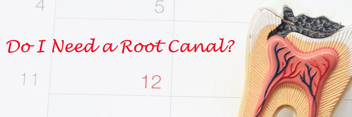 do-i-need-a-root-canal-header.jpg