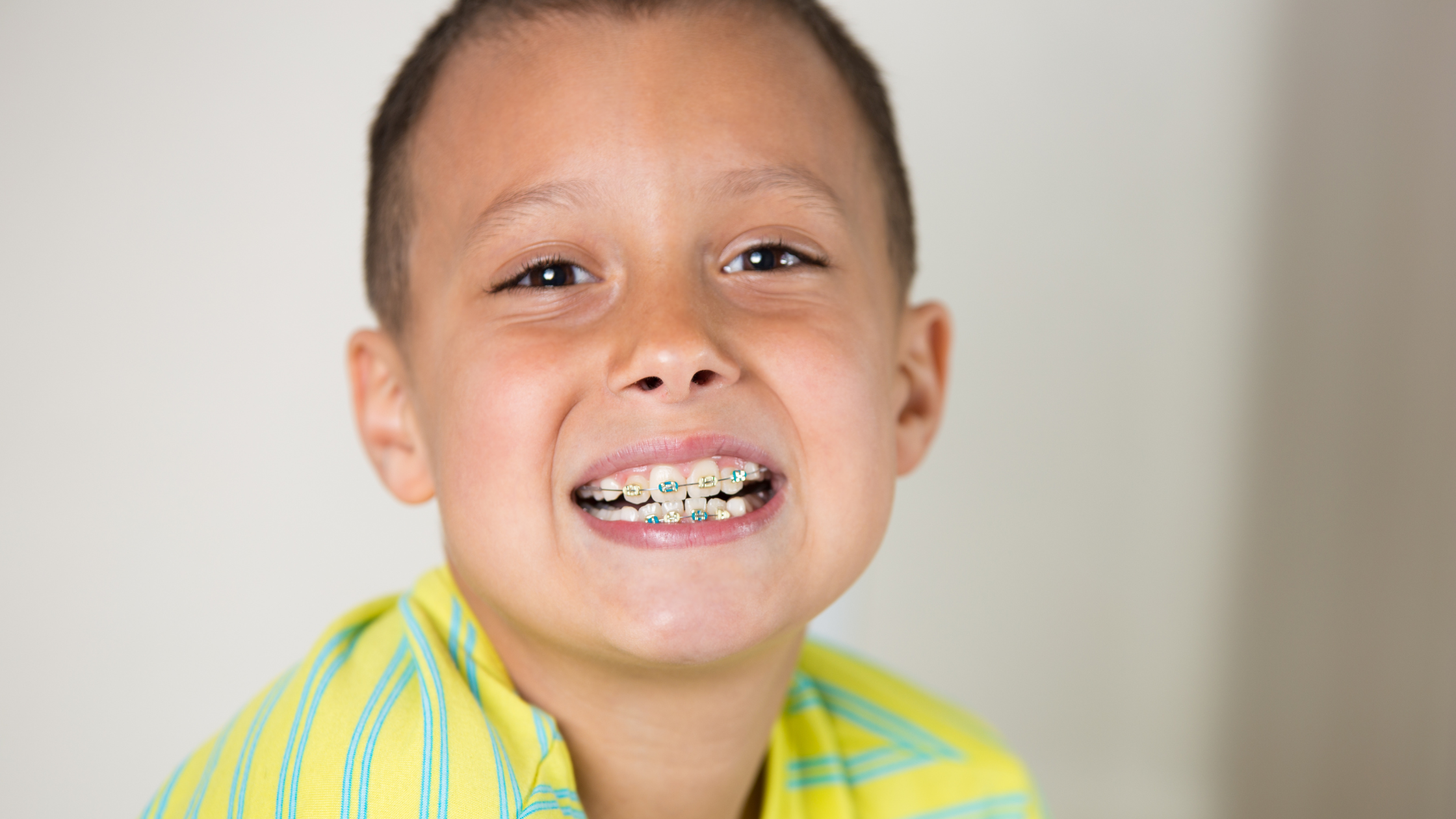 5 Surprising Signs Your Child Should See an Orthodontist