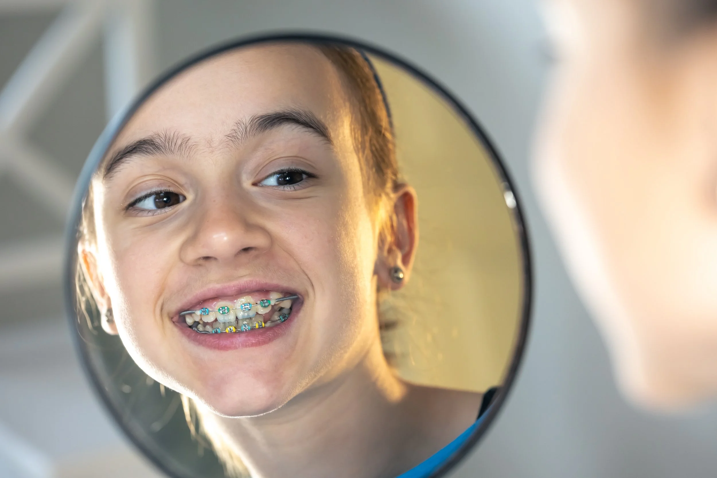 Why Orthodontic Treatment Is Planned in Phases (Not All at Once)