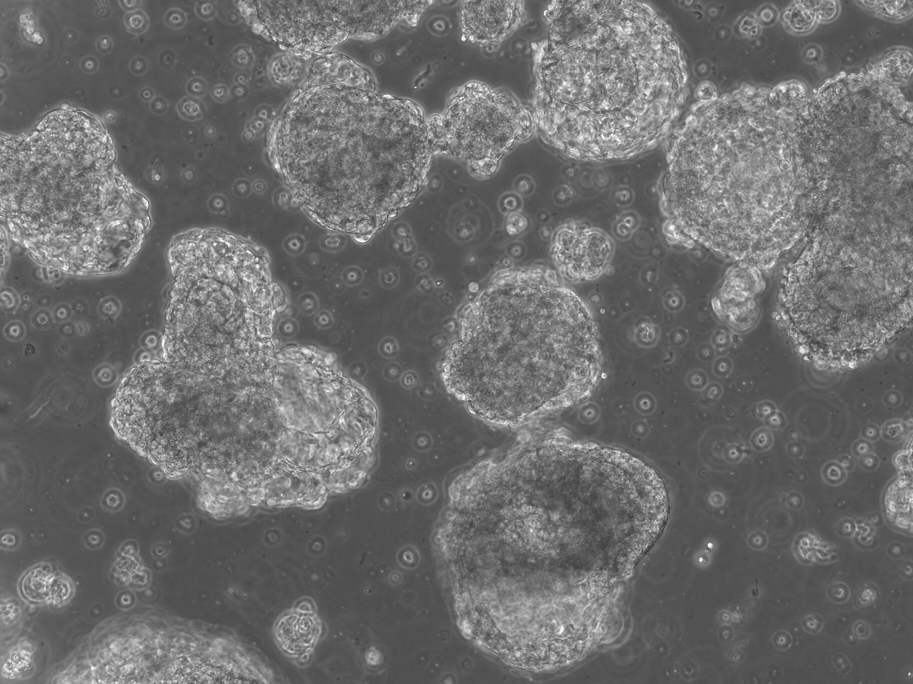 CHIR EBs - cystic structure organoids.jpg