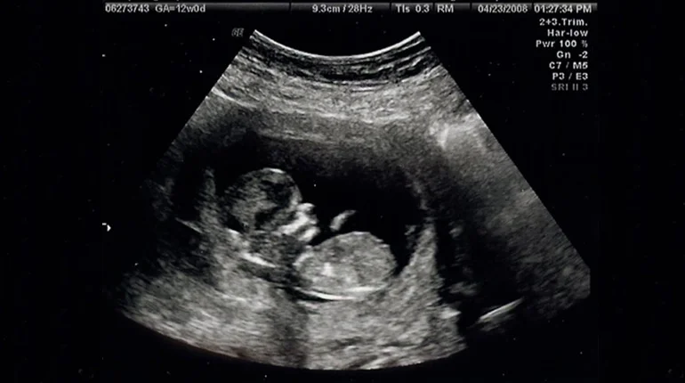 PhD-Preg_feature.jpg