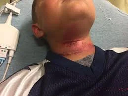 quincy-merlin-injuries_orig.jpg