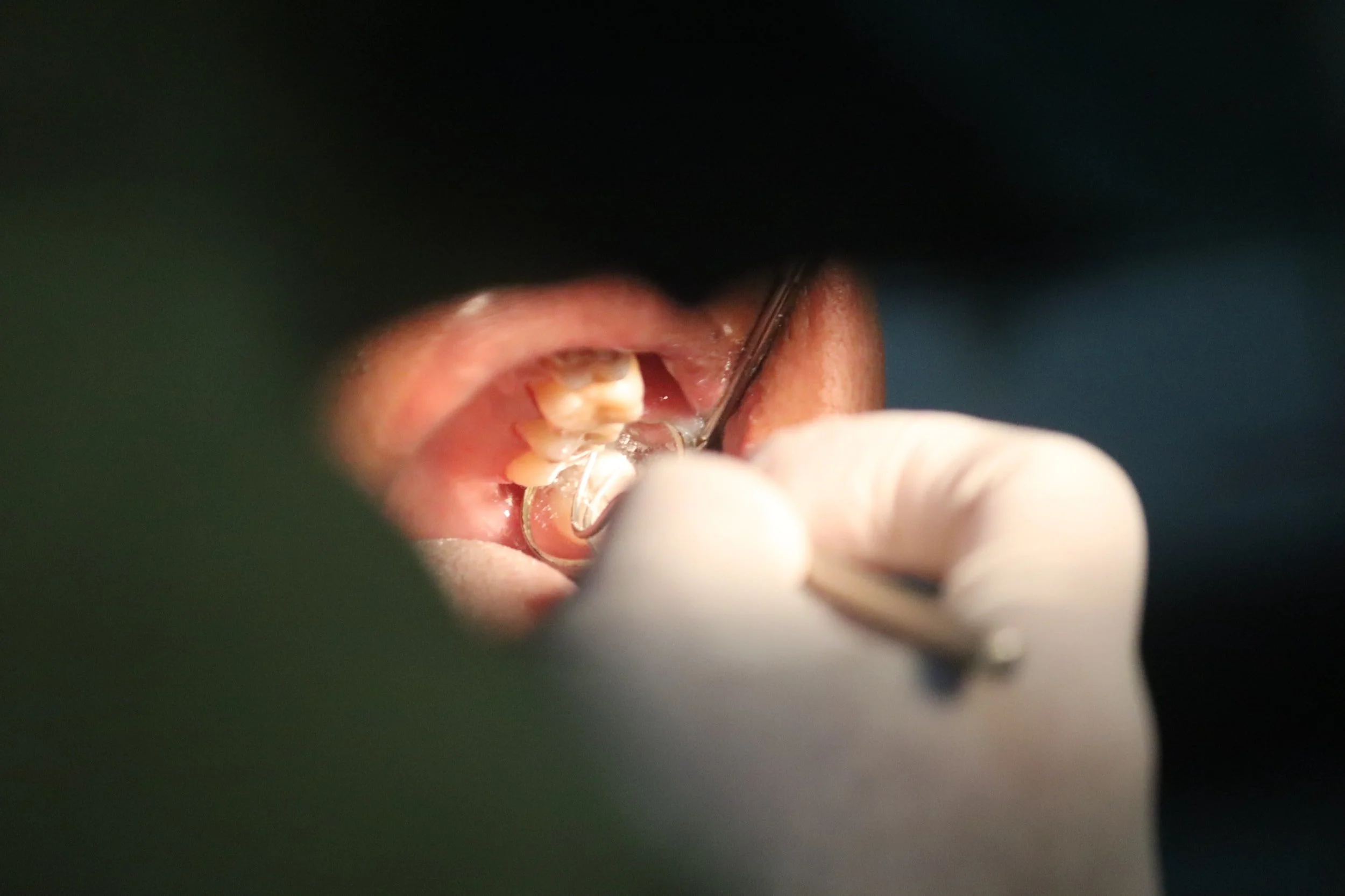 Testmyteeth’s Blog #1
