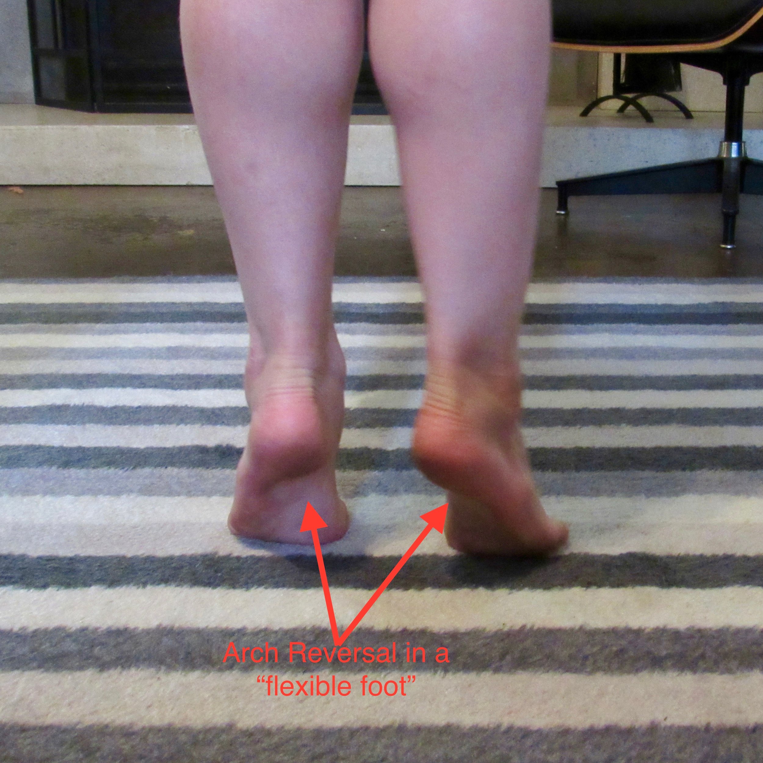 Are Flat Feet Happy Feet? — Boost Babies, LLC