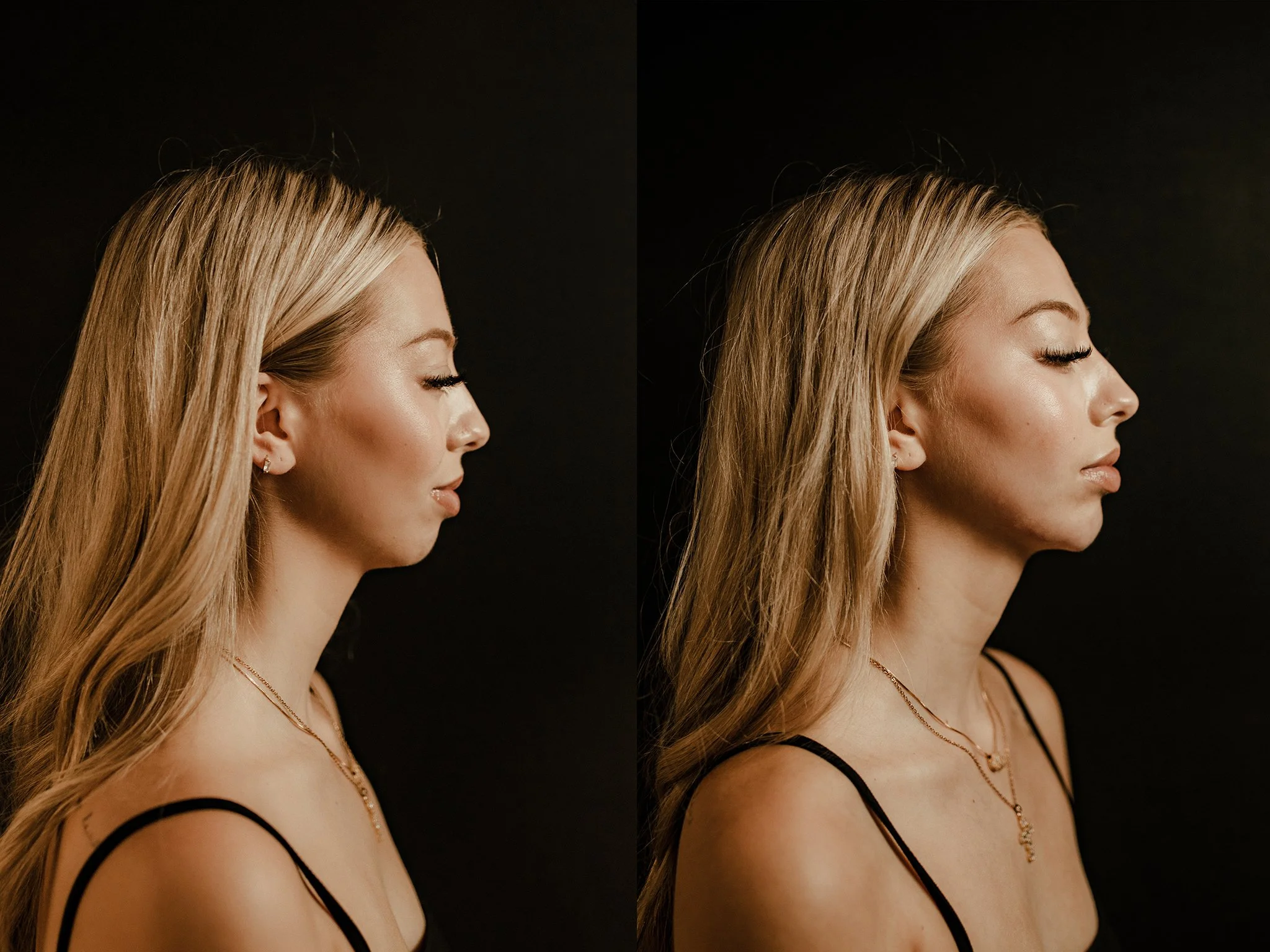 beforeafter-1.jpg