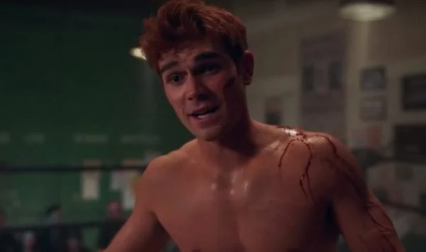 *bleeds in Archie*