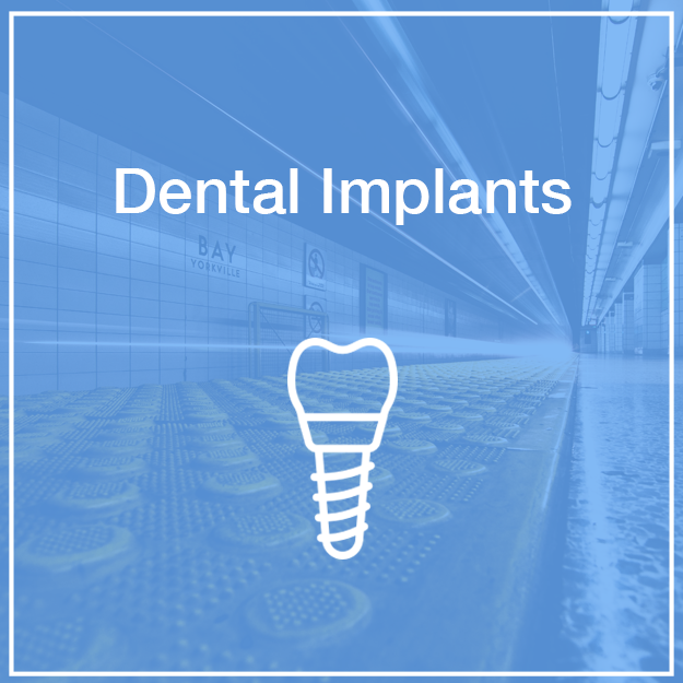 Dental Implants