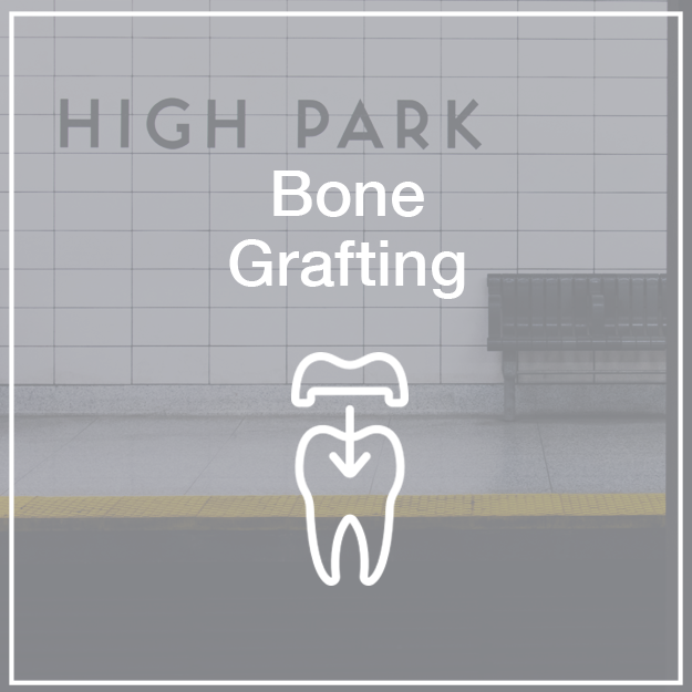 Bone Grafting