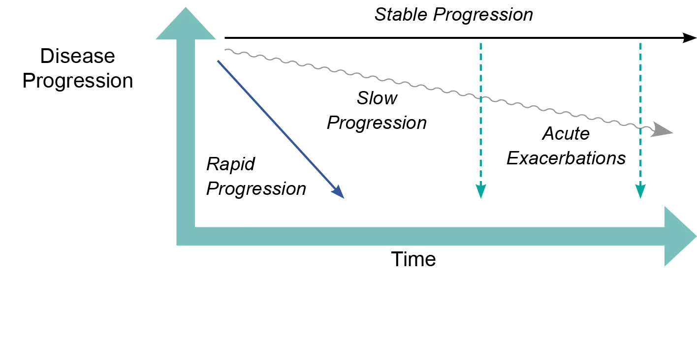 Figure 11: How IPF progresses over time (adapted from: ²¹)