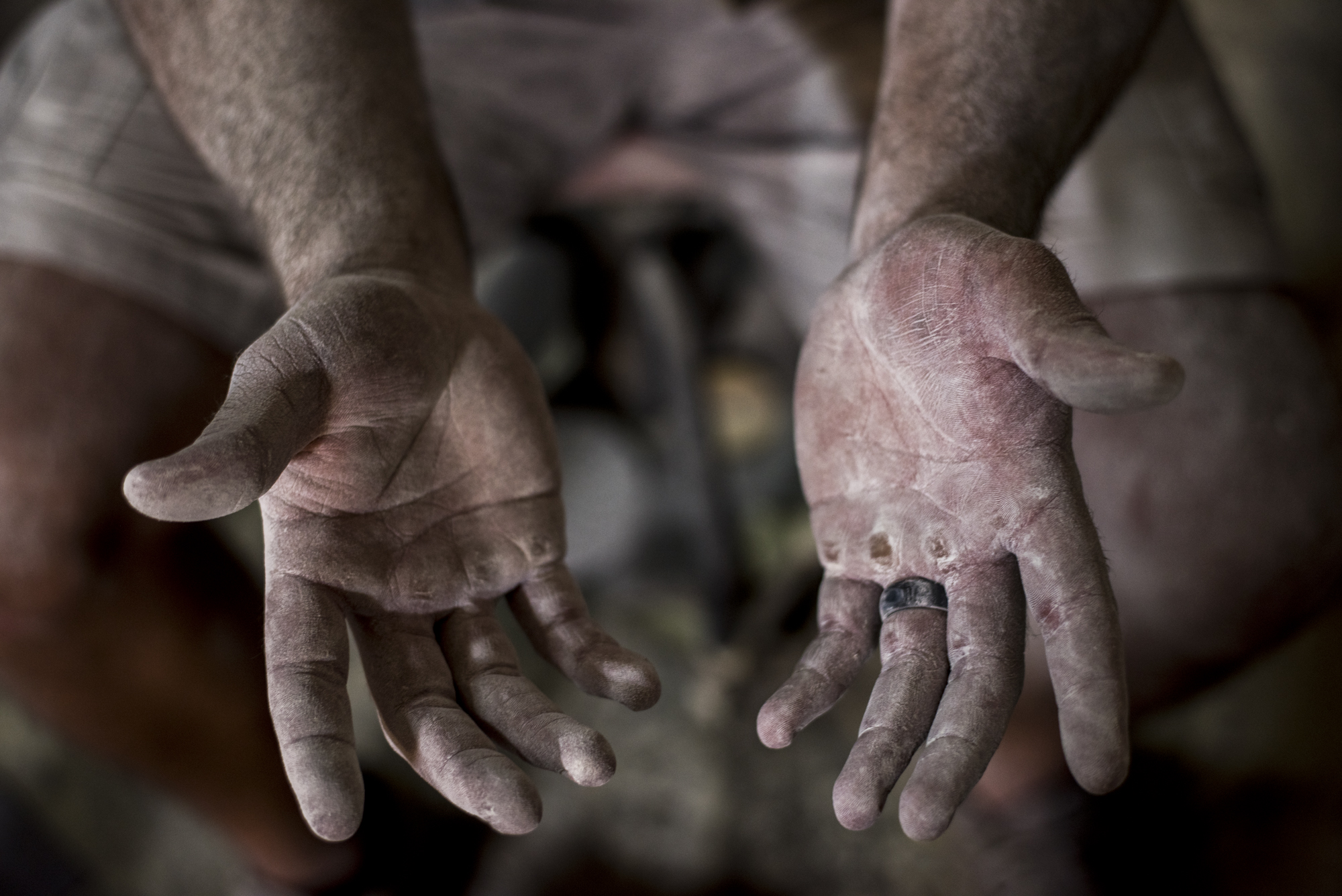  Tim Dailey holds out his hands after working on a car in his dad’s auto body shop in Cynthiana, Kentucky.  