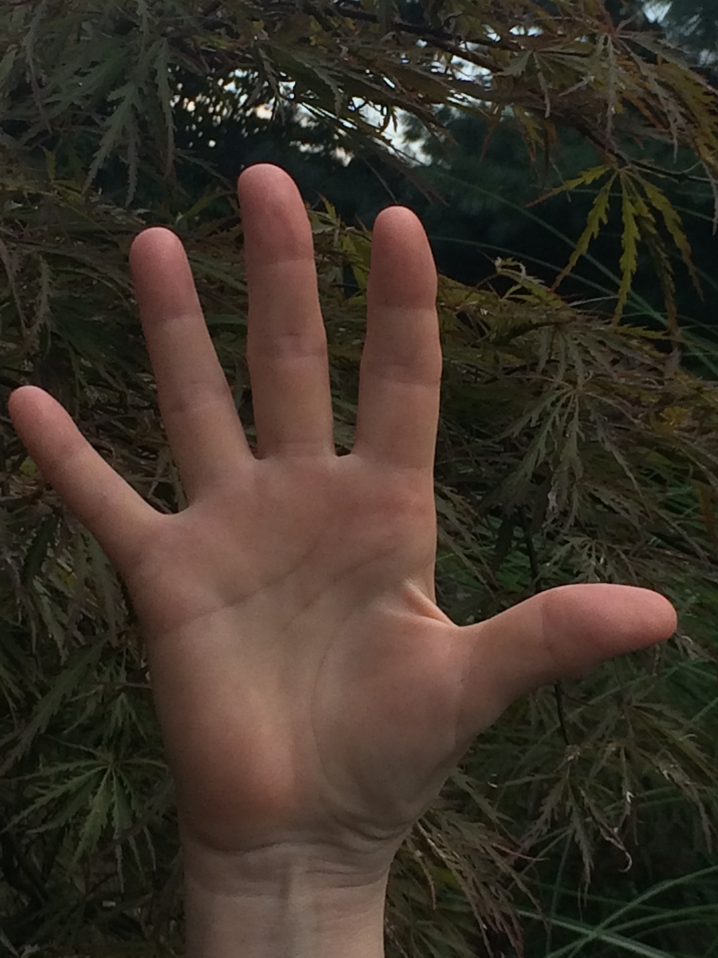 Writing a Book and Healing Trigger Finger