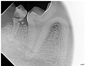 dentalxray.jpg