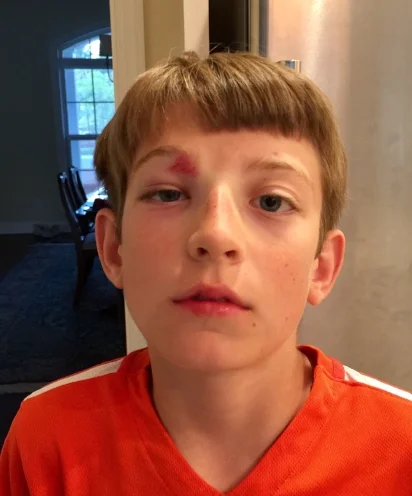 shiner.jpeg