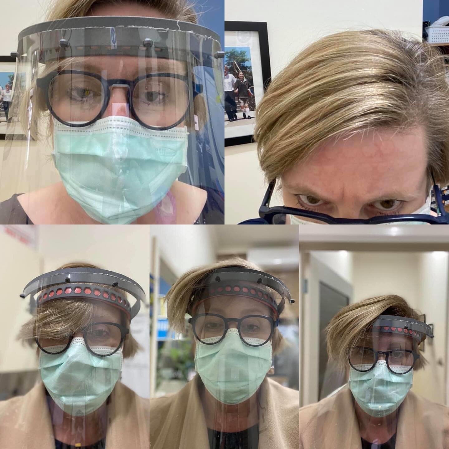 So, I didn&rsquo;t purchase the most comfortable face shields. Lucky we&rsquo;re Orthotists and have some great materials around. Liz padded it for me so no more hexagon forehead! I&rsquo;m going to have to tame that fringe though!!
#prostheticsandor