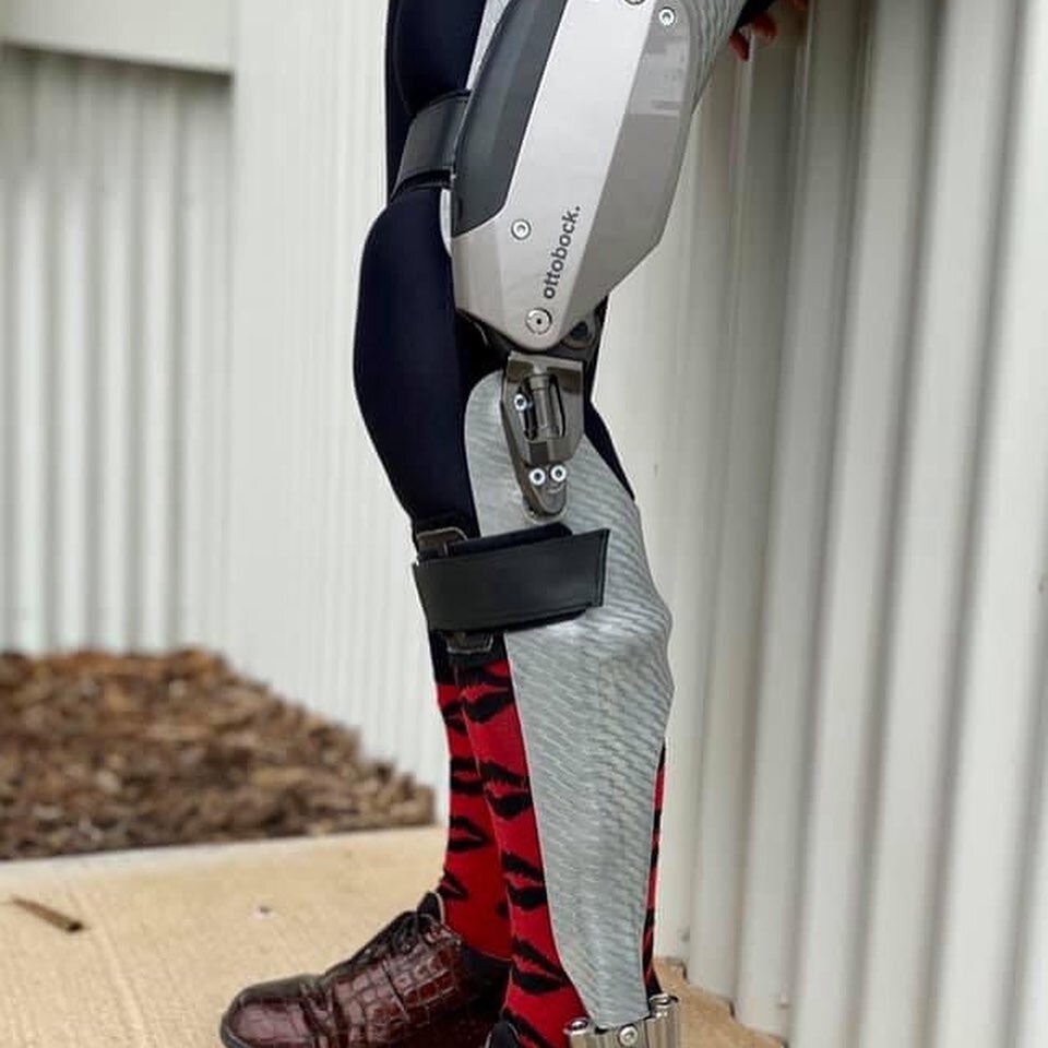 So exciting to be able to provide this high tech orthosis to our fabulous client, who has been through so much. The day was made even more special being her Birthday! The C-Brace will provide her significantly more stability, freedom of movement and 