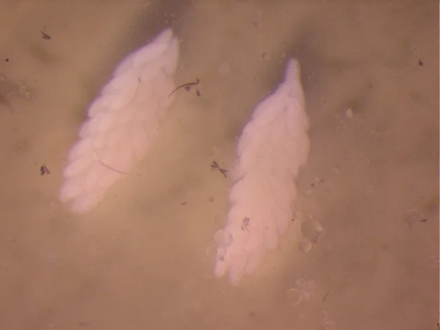 Aedes albopictus ovaries