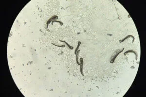 Gregarine parasites (Photo: Beth Biro/Tyson Research Center)