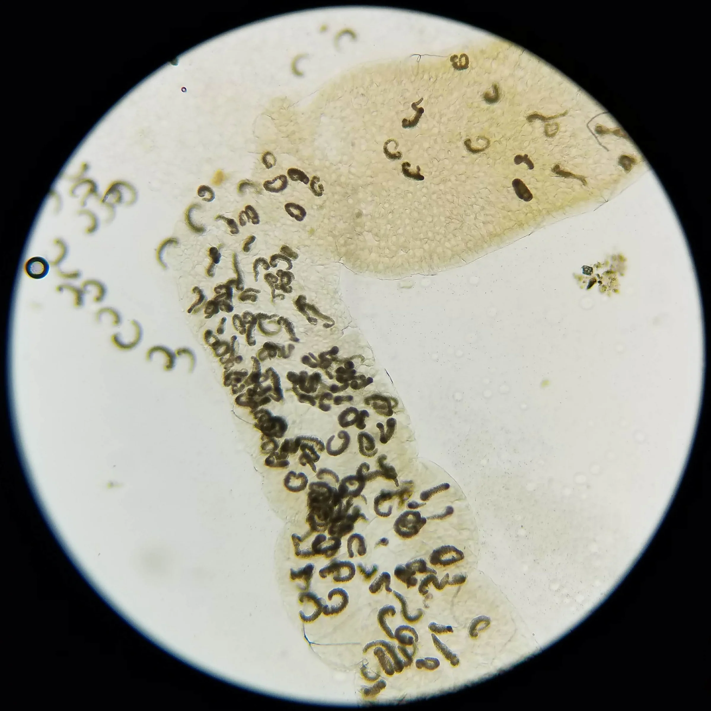 Gregarine parasites in larval midgut (Photo: Lexie Beckermann)