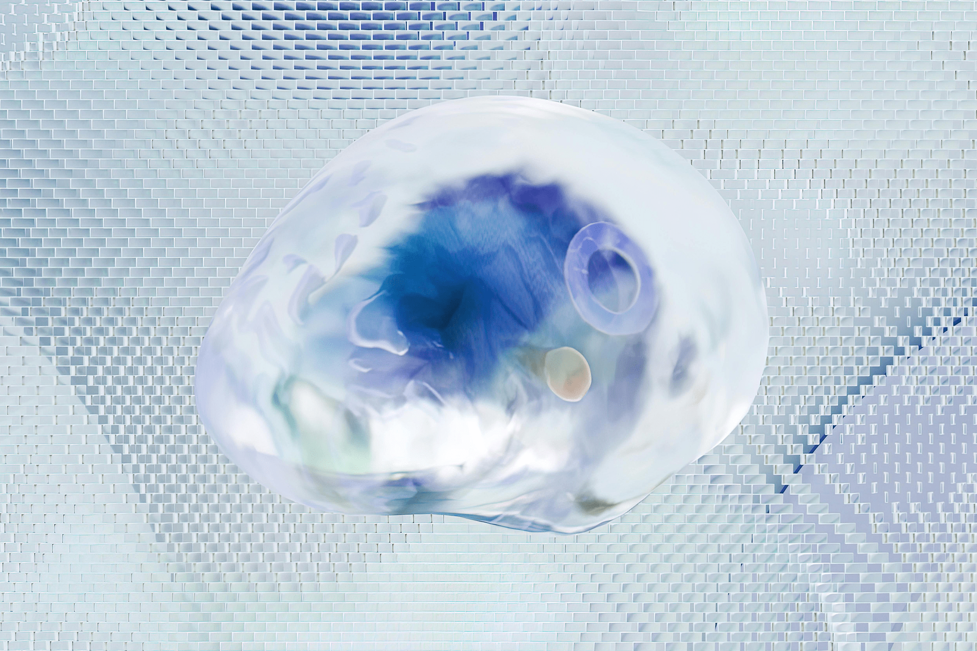 Benefits of Deep Brain Stimulation for Early Stage Parkinson Disease