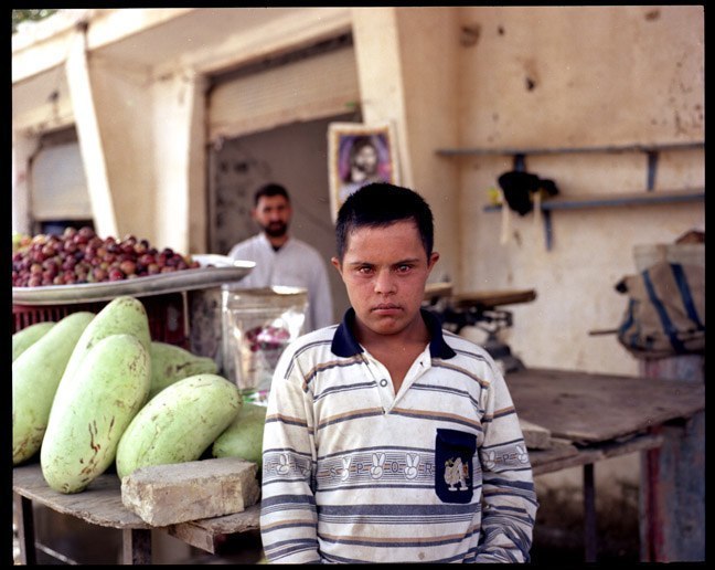  Child with down syndrome in southern Iraq. June 2003.&nbsp;   