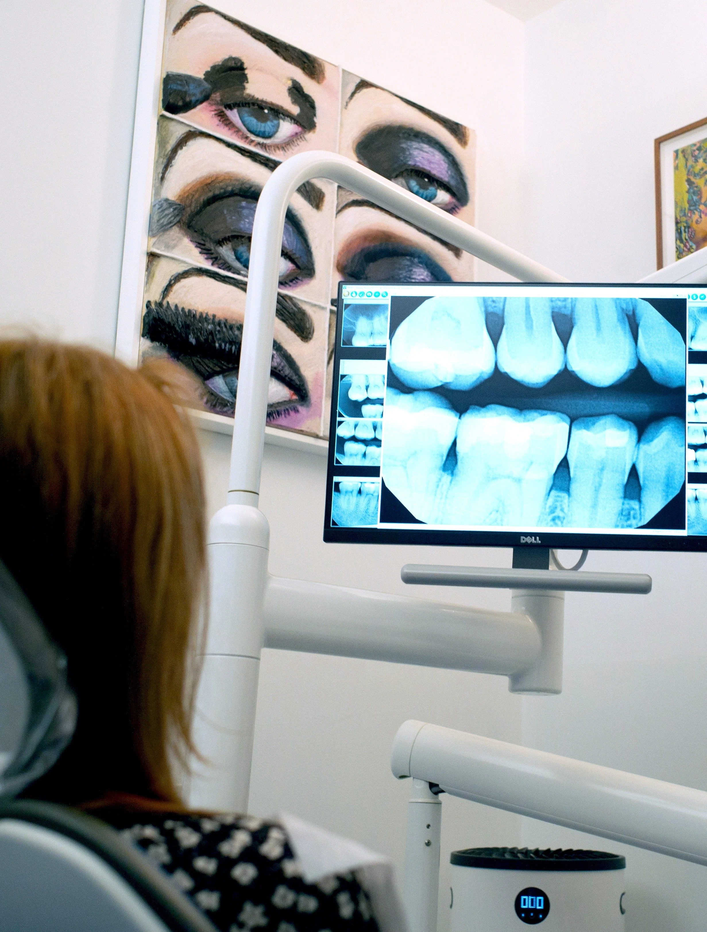 Aesthetic Foundations: Porcelain Veneers and Modern Smile Design