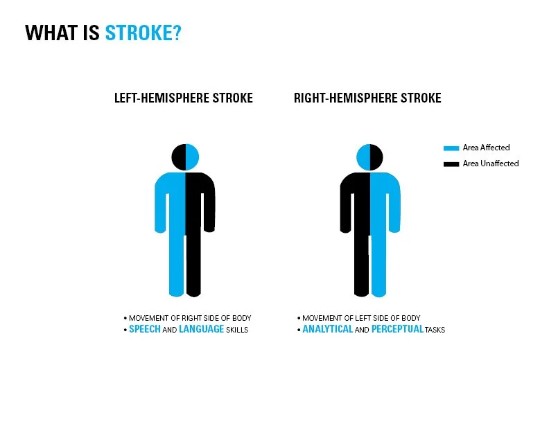 Alex-Griffith-stroke-project3.jpg