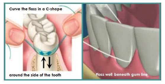 correct-flossing-technique.jpg