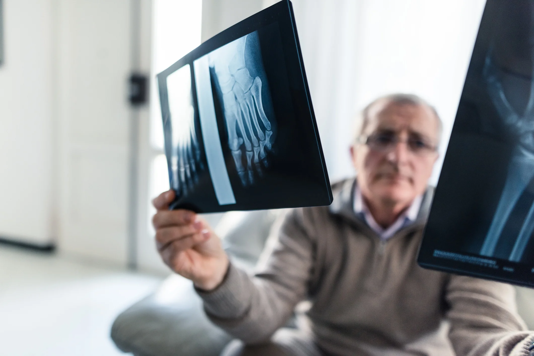 Ignorance Might Be Bliss When It Comes To Medical Scans