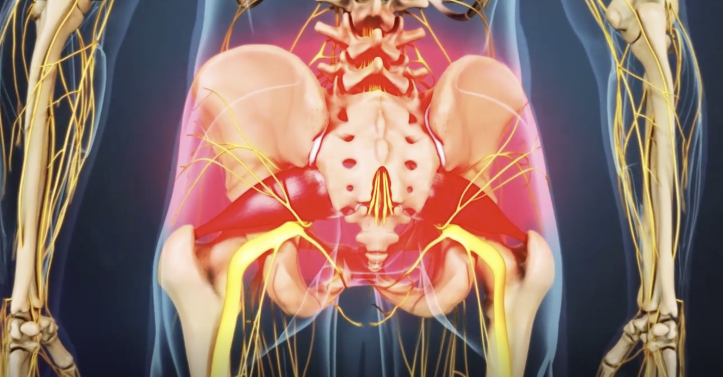 Unraveling the Complexities of Piriformis Syndrome - Academy of Clinical  Massage