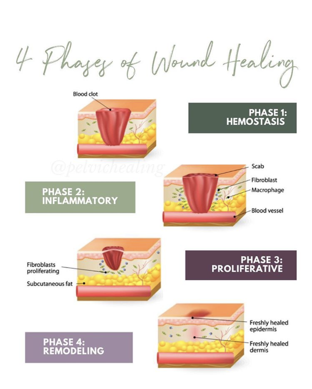 Scar Tissue and Adhesion Treatment