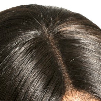 Lace-Closure-Installed.jpg