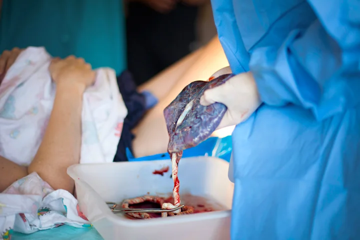 The placenta really doesn't get enough credit. Sure, the baby is the real star. But stop to consider for a moment - in addition to growing an entire being, a birthing woman also grew an extra organ. It kind of blows my mind.