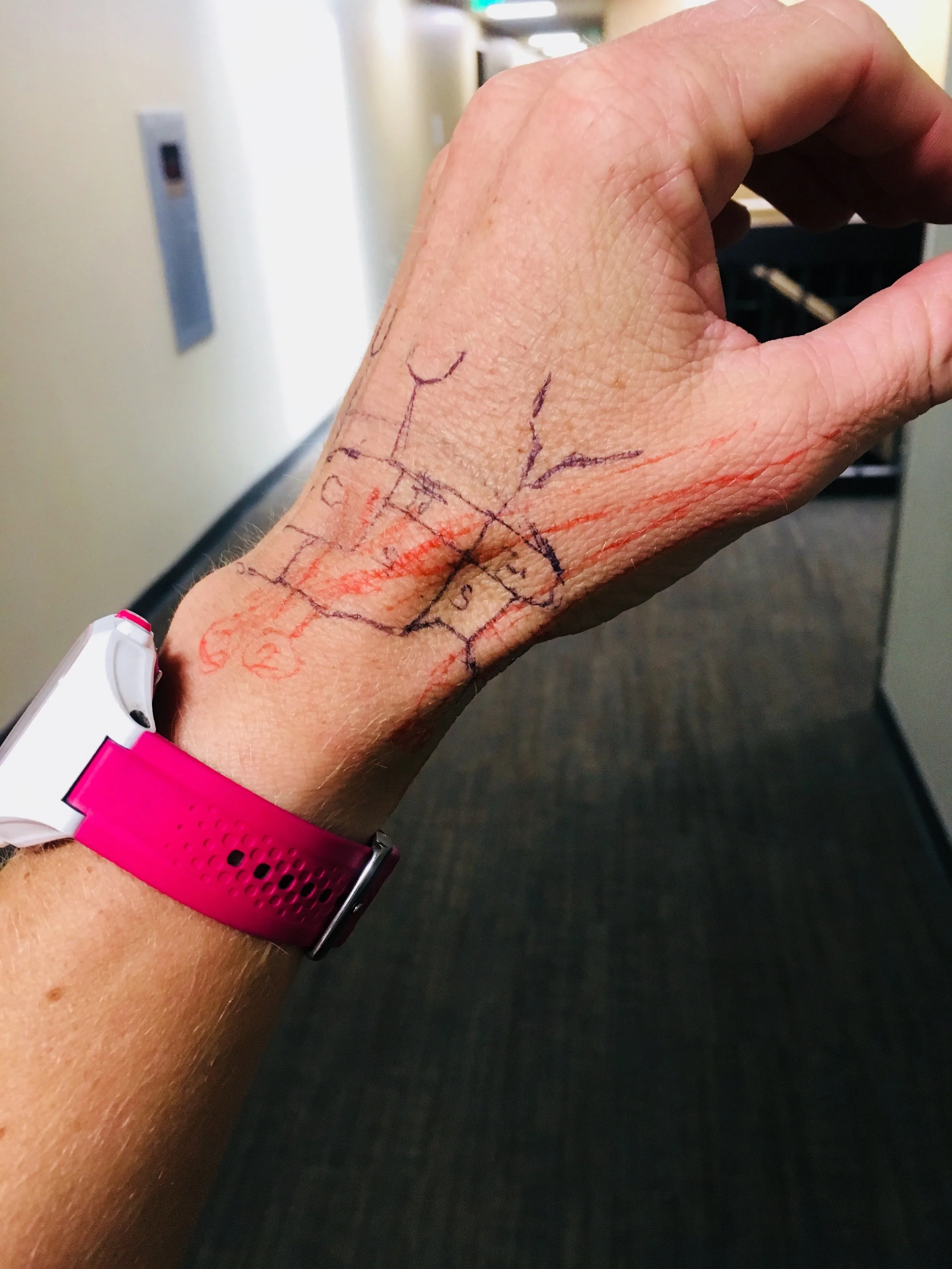 POSTPONED: Wrist &amp; thumb pain in rock climbers