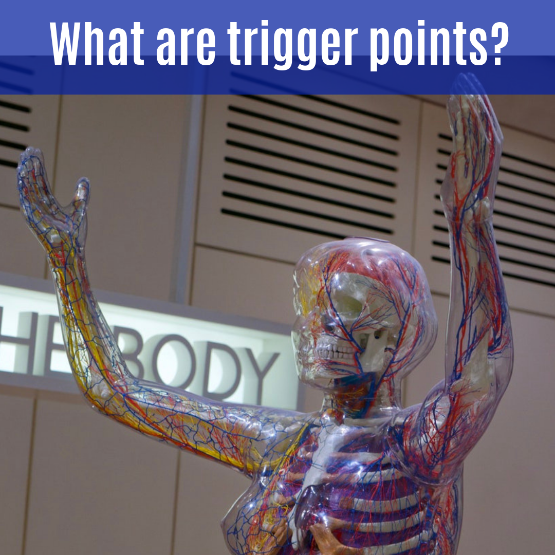 What are trigger points_.png
