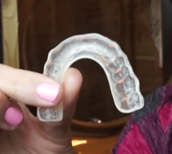 How To Clean Plastic Retainers Properly Removable Vs Fixed Retainers