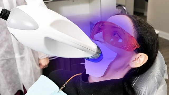 laser teeth whitening_-min.jpg