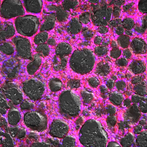 3. Dextran-TR stained Gonadal Fatpad Section of Obese Mouse.jpg