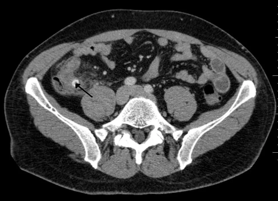 appendix.jpg