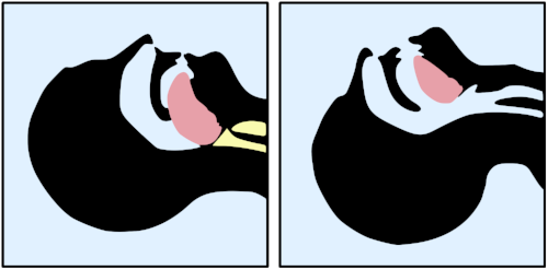 airway.png