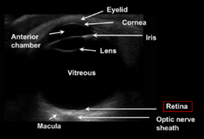 eye anatomy.png